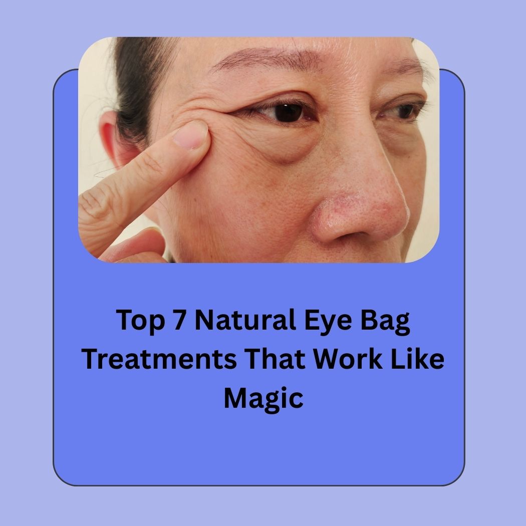 Top 7 Natural Eye Bag Treatments That Work Like Magic